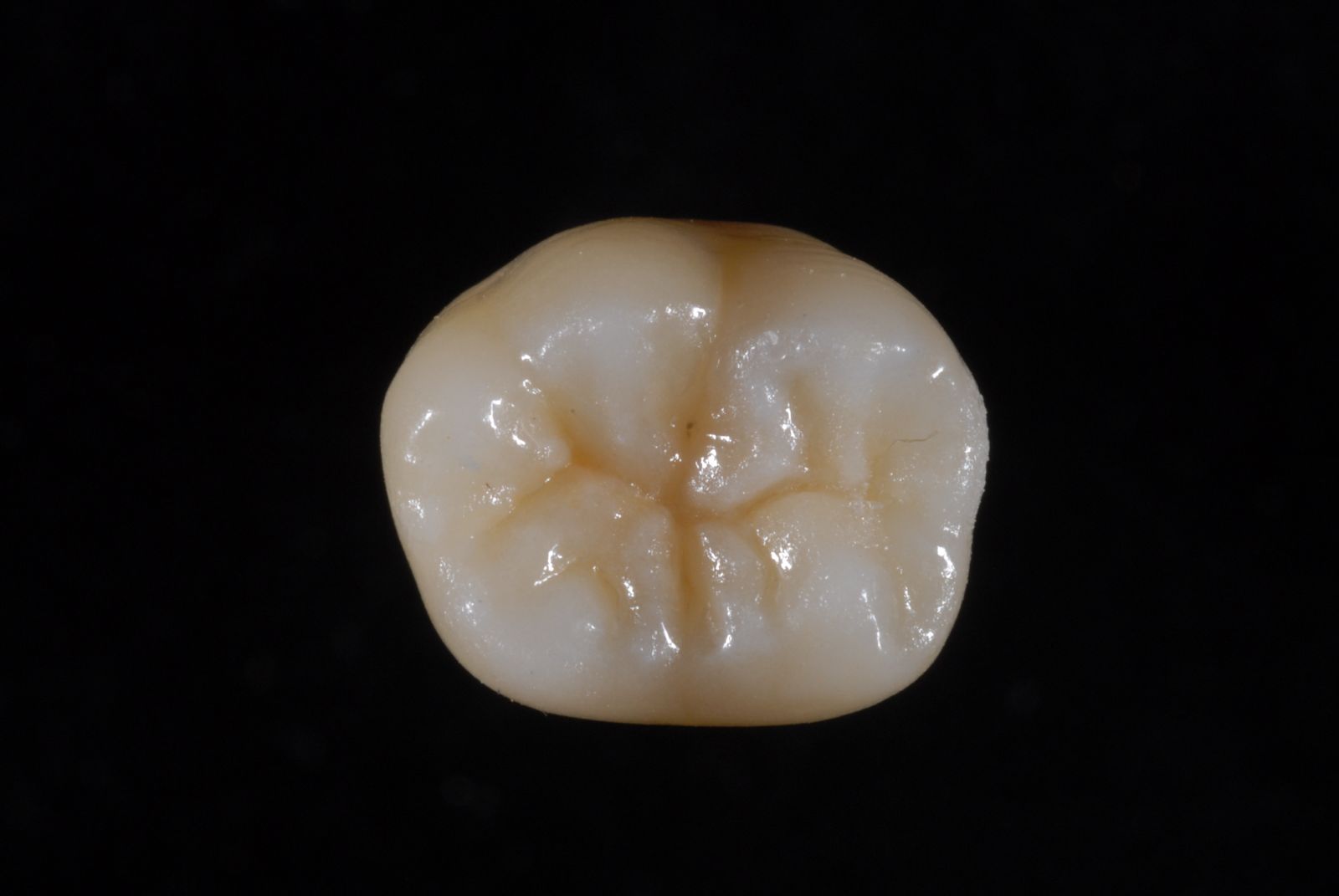 Stratificazione 36